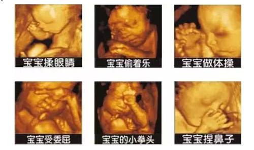 聊城怀孕做四维彩超的最佳时间(图1) 聊城怀孕做四维彩超的最佳时间(图1)