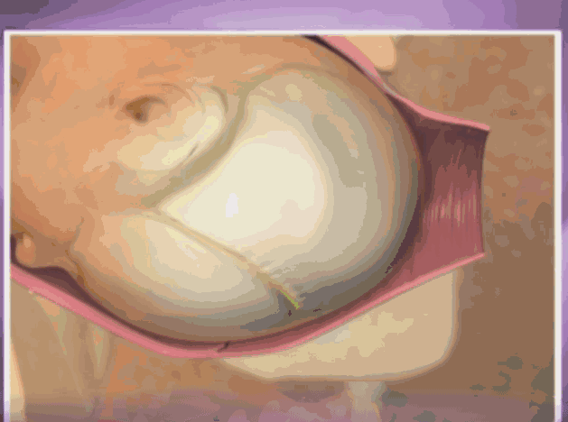 聊城博爱妇女儿童医院讲述临产前的阵痛(图6) 聊城博爱妇女儿童医院讲述临产前的阵痛(图6)