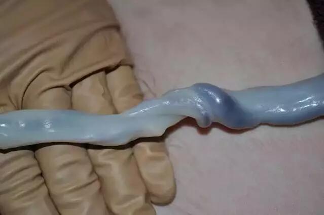 只有3%的宝宝才能享受到的“晚断脐”待遇(图6)